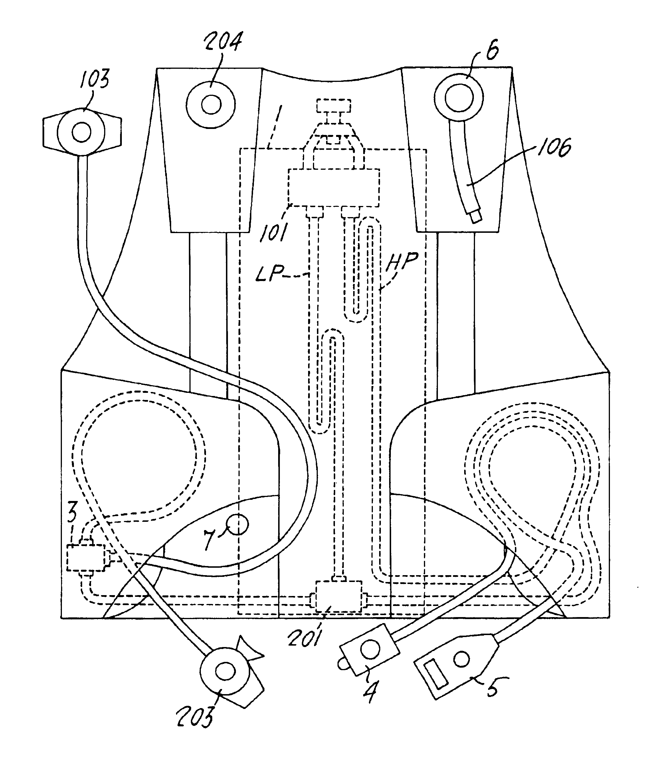 US6749369B2, drawing sheet 1